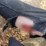East London Dog Attack Raises Questions After Known Rottweilers Mauled Woman