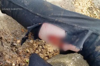 East London Dog Attack Raises Questions After Known Rottweilers Mauled Woman
