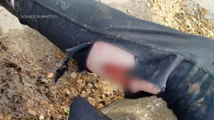 East London Dog Attack Raises Questions After Known Rottweilers Mauled Woman